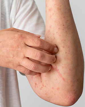 Skin Care Specialist in Chennai