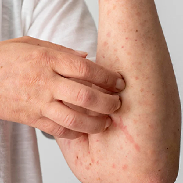 Skin Care Specialist in Chennai